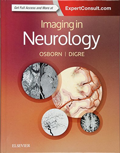 Imaging in Neurology - Amazon Royaume-Uni à 11.19€