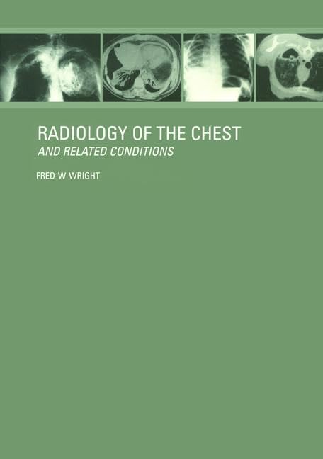 Radiology of the Chest and Related Conditions: Together... - High-Tech & Électronique Amazon Royaume-Uni à 369.61€