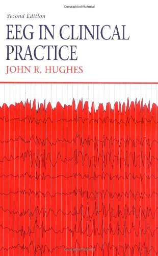 Eeg in Clinical Practice - Livres & eBooks Amazon Italie à 315.93€