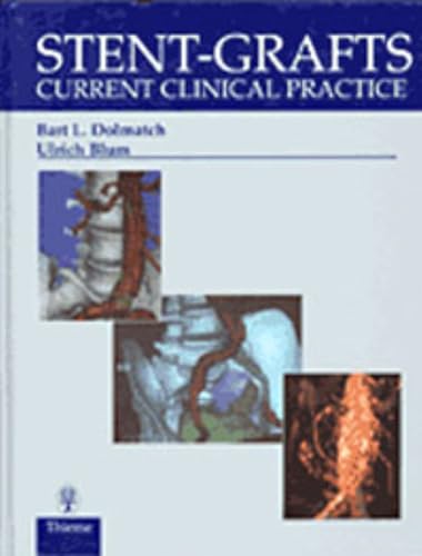 Stent-Grafts: Current Clinical Practice - Livres & eBooks Amazon Allemagne à 15.00€