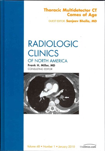Thoracic Multidetector CT Comes of Age, An Issue of... - Amazon Espagne à 25.34€