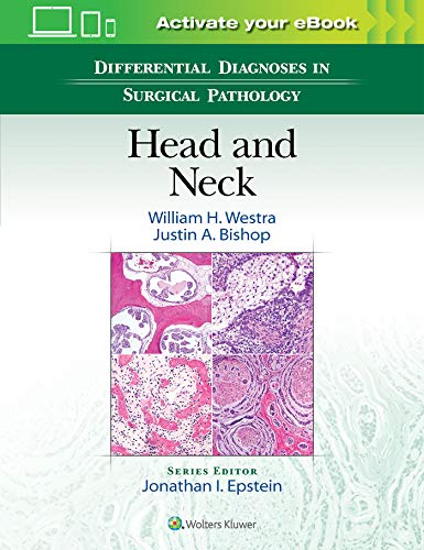 Differential Diagnoses in Surgical Pathology: Head and Neck - Livres & eBooks Amazon Italie à 166.07€