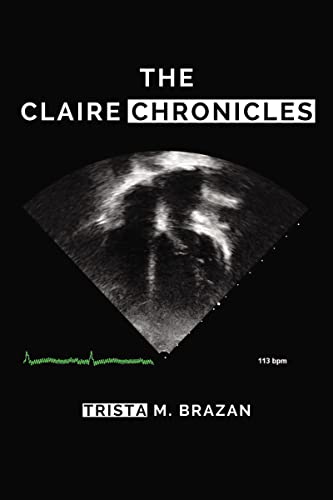 CLAIRE CHRONICLES - Amazon Espagne à 3.92€