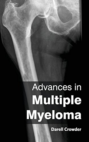 Advances in Multiple Myeloma - Amazon Royaume-Uni à 20.78€