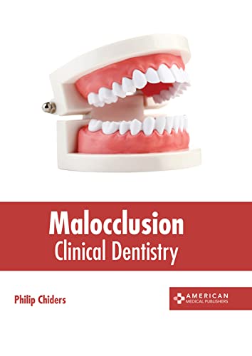 Malocclusion: Clinical Dentistry - Livres & eBooks Amazon Royaume-Uni à 30.00€