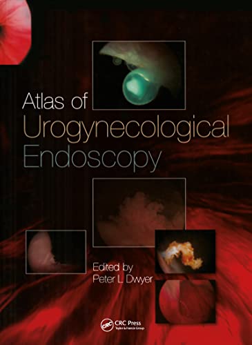 Atlas of Urogynecological Endoscopy - Santé & Bien-être Amazon Royaume-Uni à 20.00€