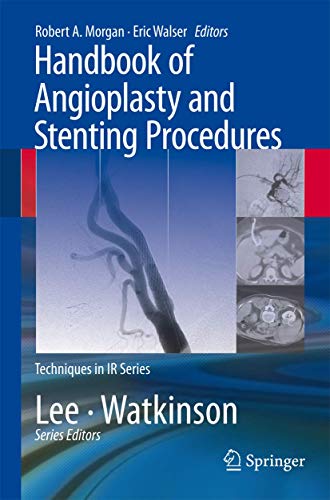Handbook of Angioplasty and Stenting Procedures (Techniques... - Bon plan à 8.87€