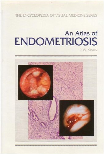 An Atlas of Endometriosis (The Encyclopedia of Visual... - Bricolage & Outils Amazon Allemagne à 15.81€