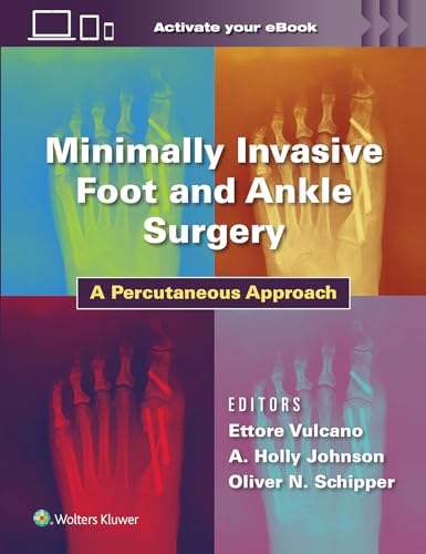 Minimally Invasive Foot and Ankle Surgery: A Percutaneous... - Erreur de prix -77% à 12.15€
