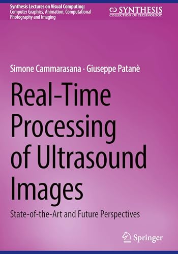 Real-Time Processing of Ultrasound Images: State-of-the-Art... - High-Tech & Électronique Amazon Espagne à 51.99€