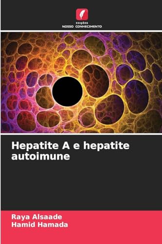 Hepatite A e hepatite autoimune - Auto & Motorcycle Amazon Spain à 16.68€