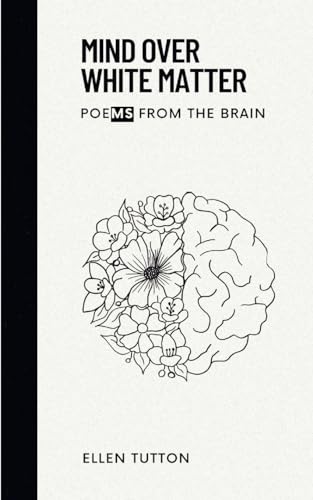 Mind Over White Matter - Livres & eBooks Amazon Royaume-Uni à 3.11€