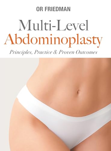 MULTI-LEVEL ABDOMINOPLASTY - DIY & Tools Amazon Spain à 58.26€