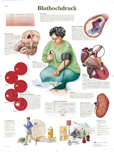 3B Scientific lehrtafek ipertensione, 1 - Santé & Bien-être Amazon Italie à 7.12€