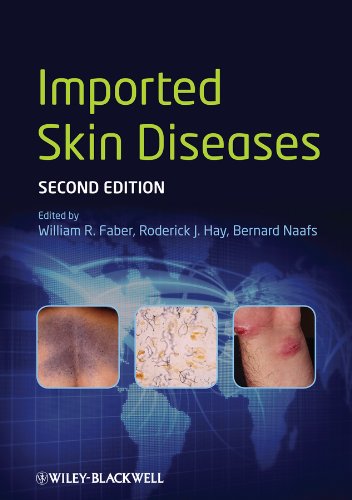 Imported Skin Diseases - Sports & Fitness Amazon Royaume-Uni à 46.54€