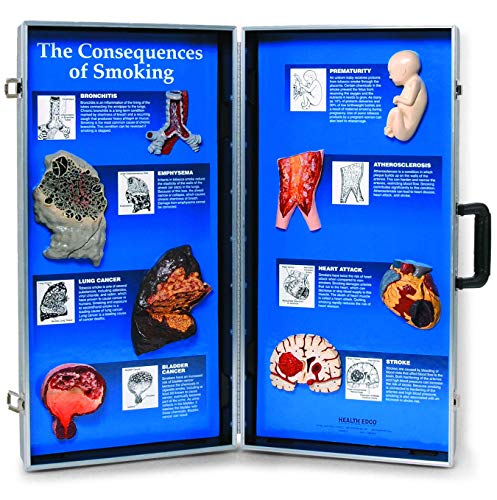 3B Scientific Conseguenze del fumo, Info Board 3D - DIY & Tools Amazon Italy à 280.97€