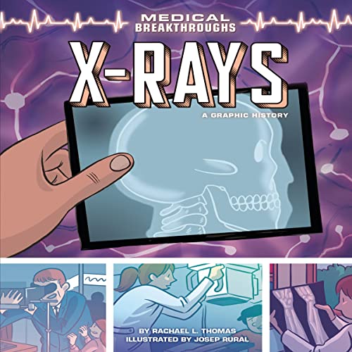 X-Rays: A Graphic History: Medical Breakthroughs - Amazon Royaume-Uni à 3.50€