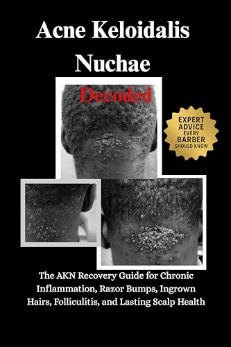 Acne Keloidalis Nuchae Decoded: The AKN Recovery Guide for... - Beauté & Parfums en promo à 2.19€